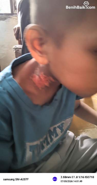 Benihbaik2026-05-2017792550946a0d4736af7d5.jpeg