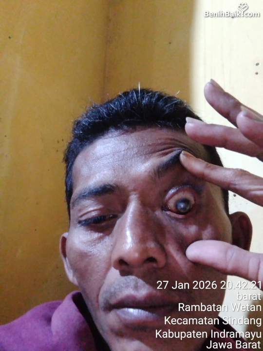 Benihbaik2026-06-0517806625766a22c1306f843.jpeg