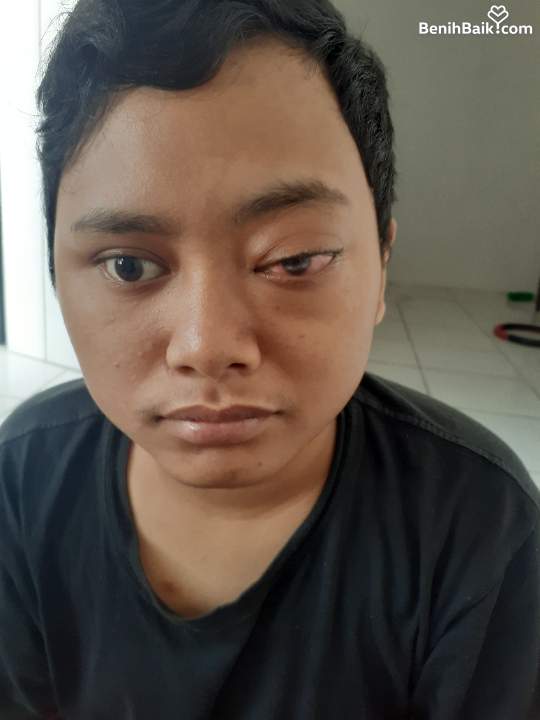 Benihbaik2026-08-1917871007496a84fe4d30e15.jpeg