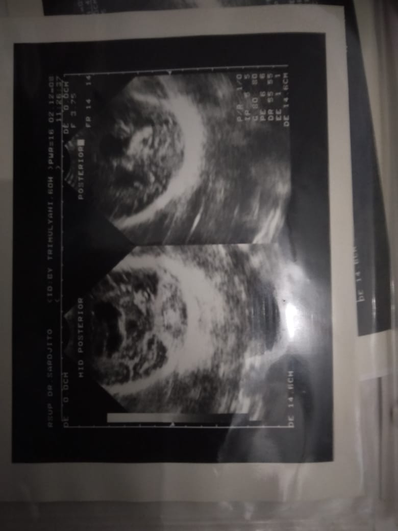 benihbaik_2020-12-09_551785c964ec637045dec1a27fee350612c49cd1_jpeg