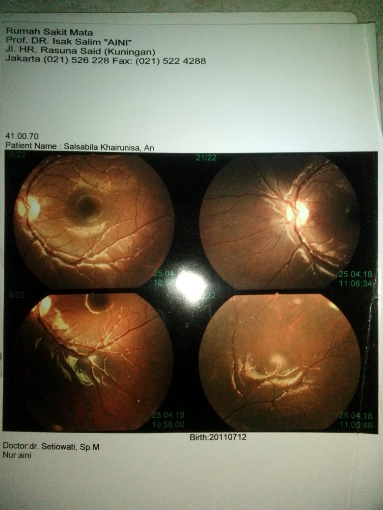 benihbaik_2021-03-29_6e2709a2bac32c17a0587f9303ddae6b70593b62_jpeg