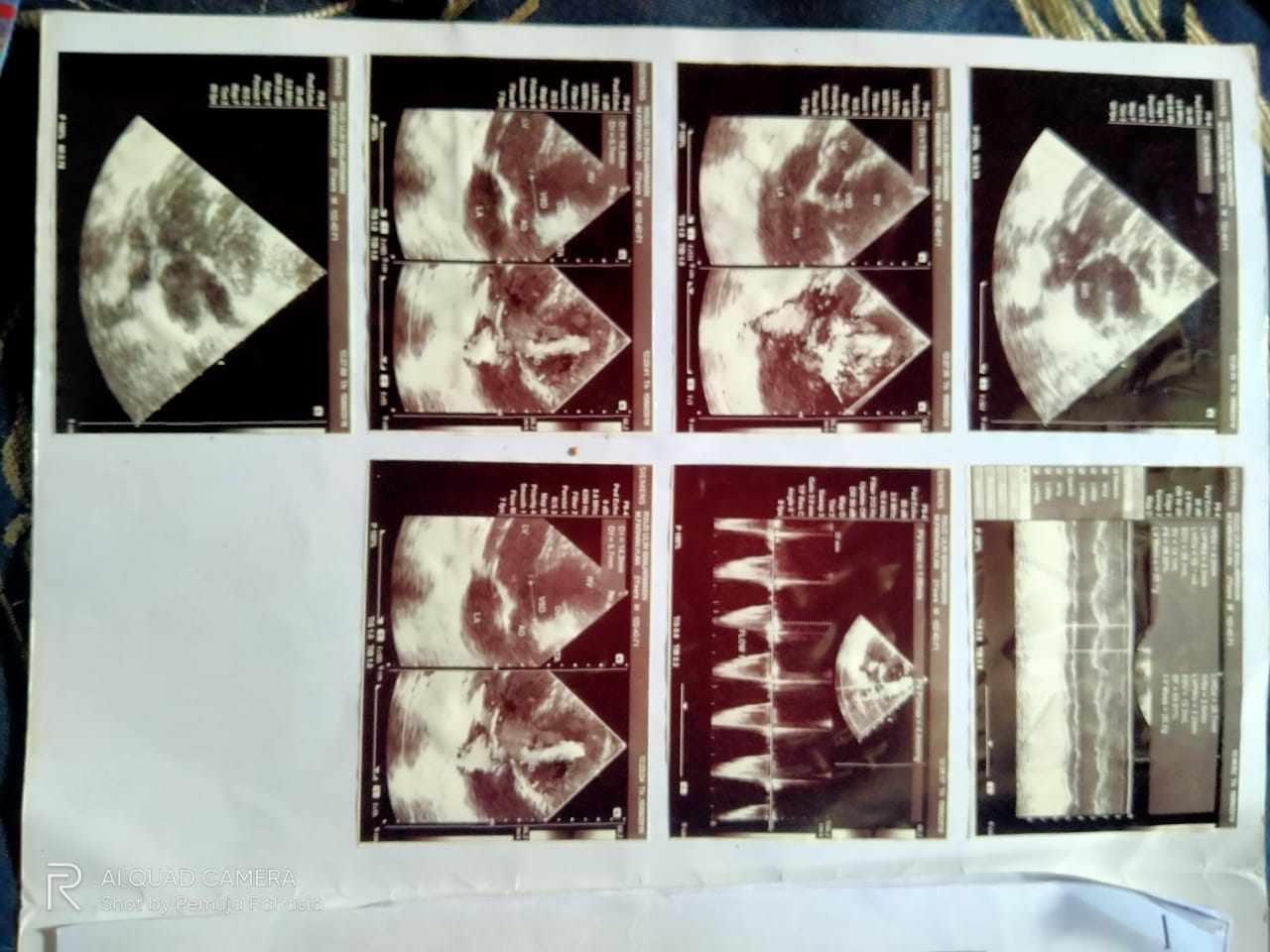 benihbaik_2021-05-07_80b3ecac68fae40f542f13766ee3d7cf41fbdd3b_jpeg