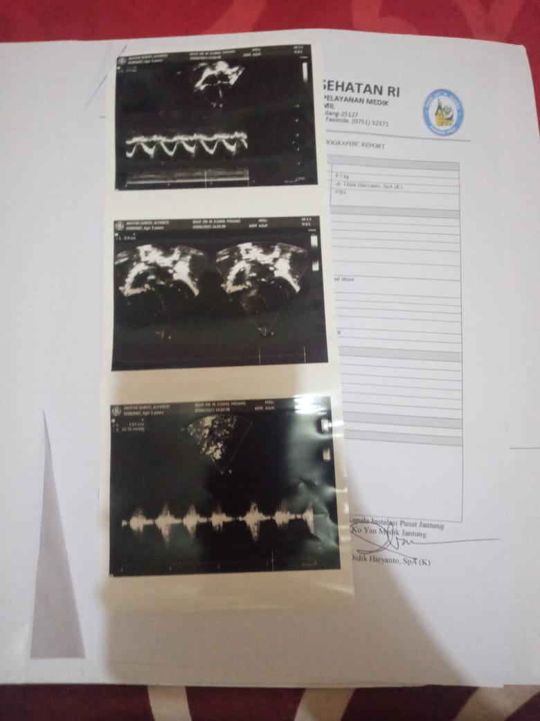 benihbaik_2021-08-24_1b6f94395ee3998a819435cae0681ebfb74facfa_jpeg