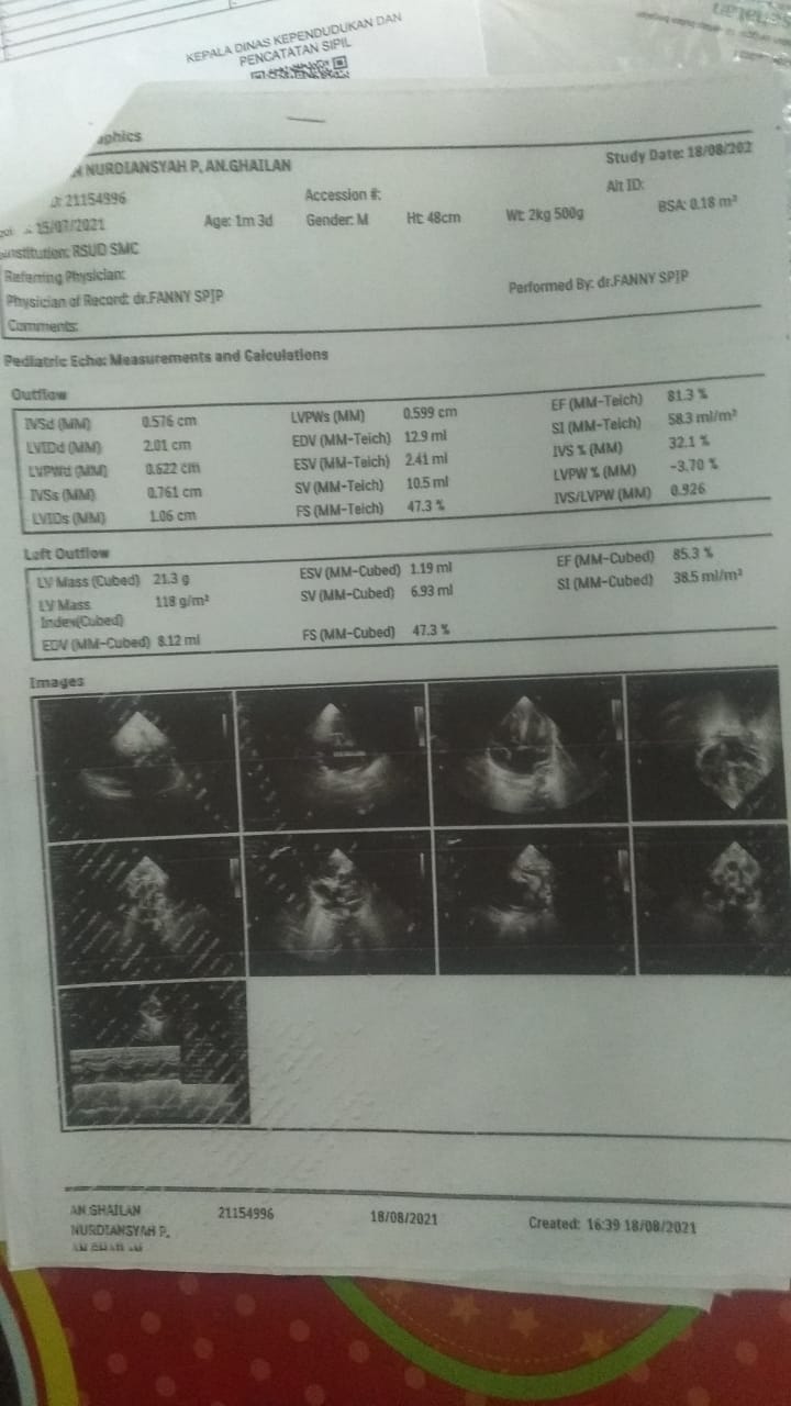 benihbaik_2021-10-11_188edc3abfdef055c67348003e13b295e55a5b47_jpeg