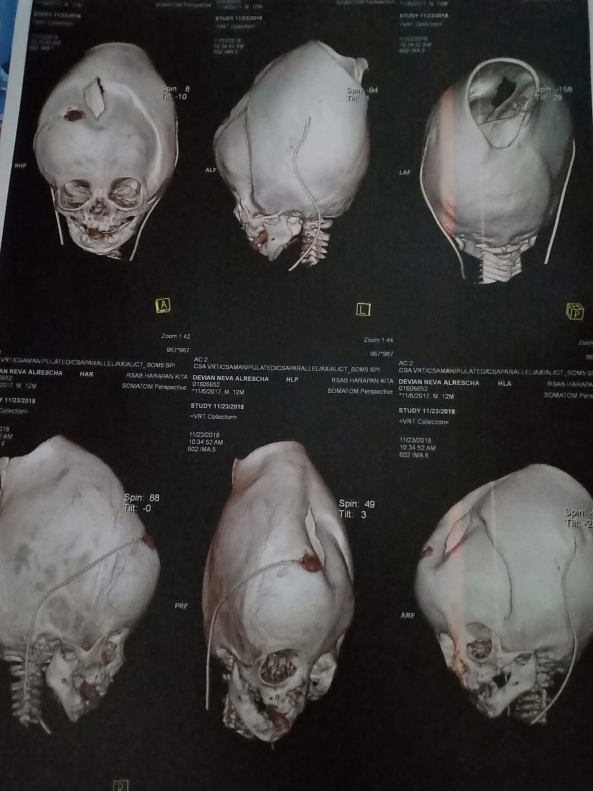 benihbaik_2021-10-13_7f11850480a414afad4db382e4262f04fc65f2ed_jpeg