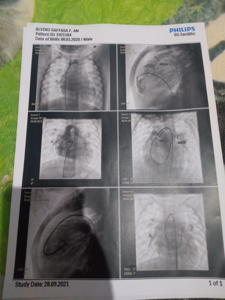 benihbaik_2021-11-19_73ae7b9fb7c11a7dbce33ca57d27acf5812dfad3_jpeg