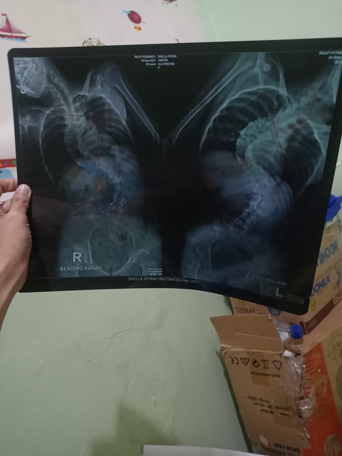 benihbaik_2022-03-11_56cf7e89bc09191ca3f310b221ce31828fd7f228_jpeg