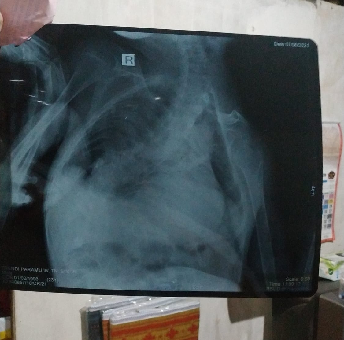 benihbaik_2022-04-11_0619b1592df52b72b6b658223ef6d99f90b619b7_jpeg