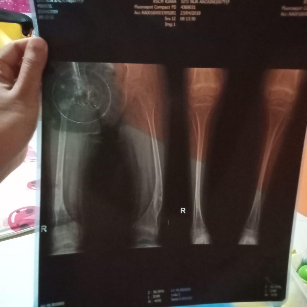 benihbaik_2022-06-10_681844294434ed466e196bbb590fa231de2d92e5_jpeg