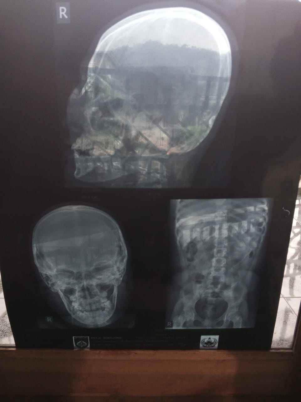 benihbaik_2023-01-03_4cd810a374ef515e517f98a161ca4acb9fb399e0_jpeg