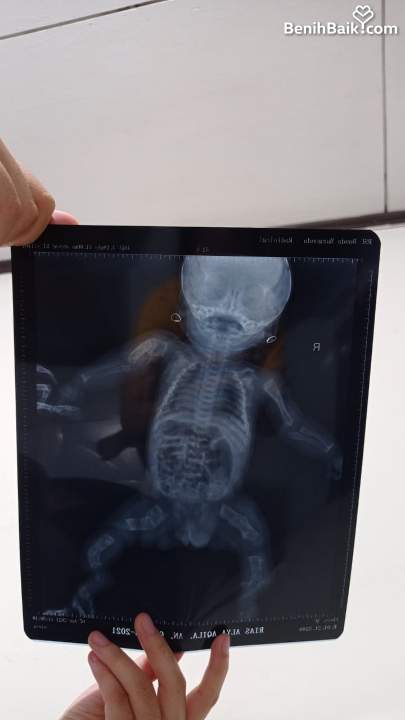 benihbaik_2023-05-10_2a2d54dab4f09fa35d4ca34c3fc591b69245d5eb_jpeg