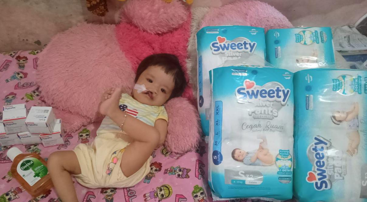 Dana Digunakan Untuk Membantu Zahra Penderita Jantung Bocor