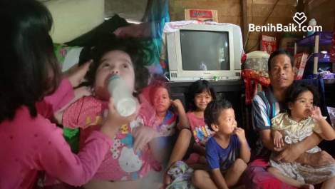 Selama 4 Tahun, Meningitis Renggut Penglihatan Syafrina, Ia Butuh Pertolonganmu