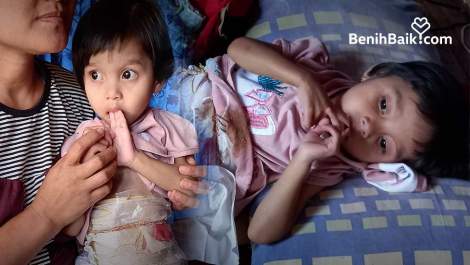 Alami Infeksi Usus Langka, Bantu Dik Nia untuk Sembuh