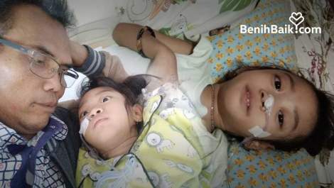 Divonis Alami Sirosis Hati, Kania Harus Segera Operasi Ligasi dan Transplantasi Hati
