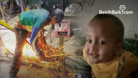 Didiagnosis Kanker Langka, Azhar Butuh Biaya Berobat