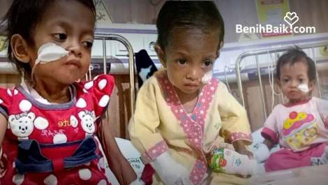 Ayahnya Hanya Jadi Kuli Panggul Kayu, Bantu Assyifa Sembuh dari Jantung Bocor