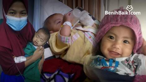 Bantu Anak Buruh Sembuh dari Penyakit Atresia Ani