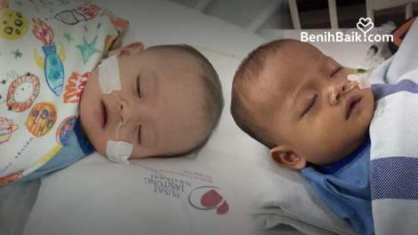 Bayi 9 Bulan Harus Segera Operasi Jantung agar Nyawanya Tertolong