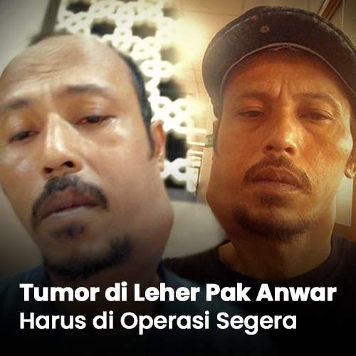 Tumor di Leher Pak Anwar Harus di Operasi Segera - BenihBaik.com