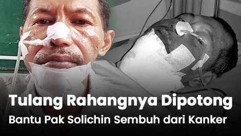 Pak Solichin Melawan Kanker Rahang Ganas