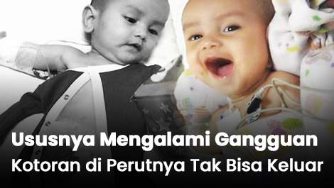 Zanki Masih Bayi, Tapi Sudah Harus Berjuang Melawan Penyakit Langka