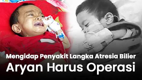 Aryan, Pejuang Kecil yang Lahir Tanpa Saluran Empedu