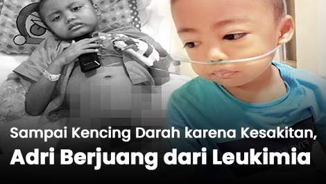 Sampai Kencing Darah karena Kesakitan, Adri Berjuang dari Leukimia
