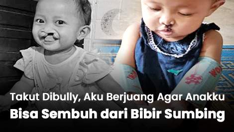 Takut Dibully, Aku Berjuang Agar Anakku Bisa Sembuh dari Bibir Sumbing