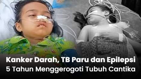 Sudah 5 Tahun! Kanker Darah, Tb Paru, dan epilepsi Menggerogoti Tubuh Cantika