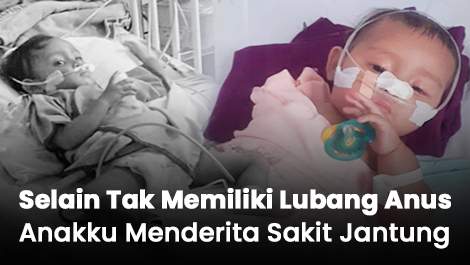 Bantu Isyana, Pejuang Kecil Dengan Sakit Jantung Dan Tidak Memiliki Lubang Anus