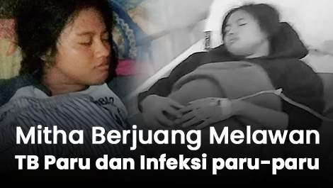 Mitha Berjuang dari TB Paru dan Infeksi paru-paru