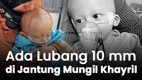 Ada Lubang 10 mm di Jantung Mungil Khayril