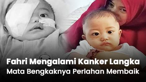 Alami Kanker Langka, Kondisi Mata Fahri yang Membengkak Perlahan Membaik