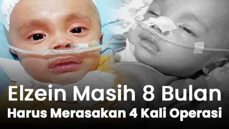 Masih 8 Bulan, Elzein Harus Merasakan 4 Kali Mencekamnya Meja Operasi