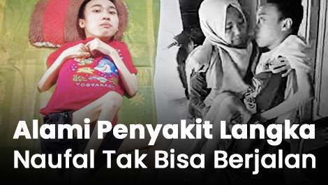 Tuhan Mengapa Anakku? Naufal Alami Penyakit Langka Hingga Tak Bisa Berjalan