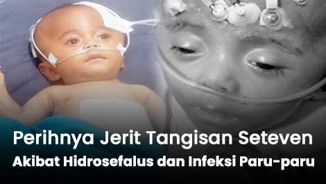 Perihnya Jerit Tangisan Seteven Akibat Hidrosefalus dan Infeksi Paru-paru