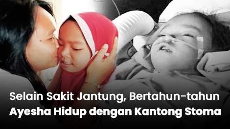 Selain sakit Jantung, Bertahun-tahun Ayesha Hidup Menggunakan Kantong Stoma di Perutnya!