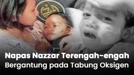 Napasnya Terengah-engah, Hidup Nazzar Bergantung pada Tabung Oksigen