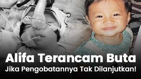 Alifa Terancam Buta Jika Pengobatannya Tak Dilanjutkan!