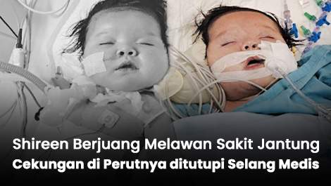 Perutnya Ada Cekungan Hingga Ditutupi Selang Medis, Shireen Berjuang Sakit Jantung