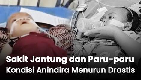 Kondisi Anindira Menurun Drastis! Ia Harus Pengobata Jantung dan Paru-paru di Jakarta