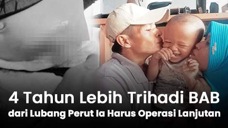 4 Tahun Lebih Trihadi BAB dari Lubang di Perutnya, Ia Harus Operasi Lanjutan