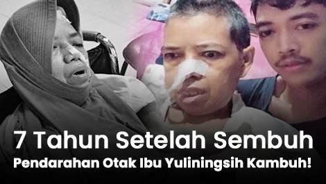 7 Tahun Setelah Sembuh, Pendarahan Otak Ibu Yuliningsih Kambuh!