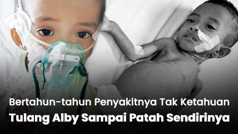Bertahun-tahun Penyakitnya Tak Ketahuan, Tulang Alby Sampai Patah Sendirinya