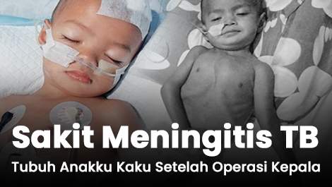 Sakit Meningitis TB, Tubuh Zeyhan Kaku Setelah Operasi Kepala