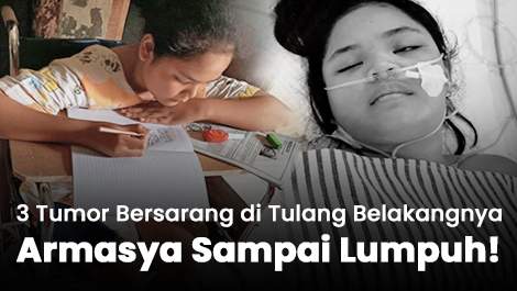 3 Tumor Bersarang di Tulang Belakangnya, Armasya Sampai Lumpuh!