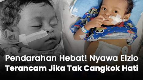 Pendarahan Hebat! Nyawa Elzio Terancam Jika Tak Cangkok Hati
