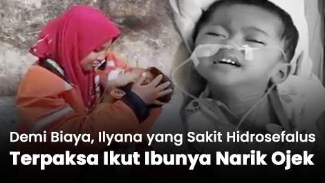 Demi Biaya, Ilyana yang Sakit Hidrosefalus Terpaksa Ikut Ibunya Narik Ojek