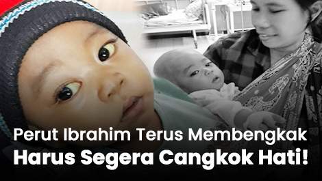 Perut Ibrahim Terus Membengkak, Harus Segera Cangkok Hati!